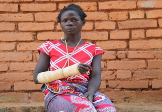 Anna nearly lost her hand when her husband hacked her during a domestic disagreement ©UNFPA/Scott