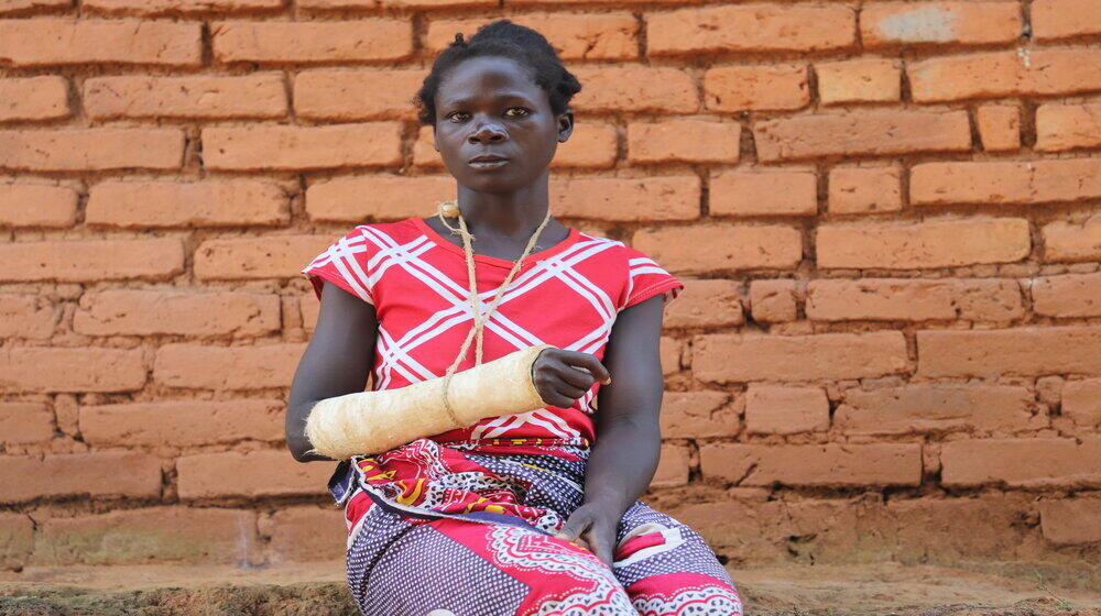 Anna nearly lost her hand when her husband hacked her during a domestic disagreement ©UNFPA/Scott